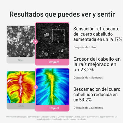 Tratamiento Cuero Cabelludo Rosemary